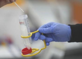 DSÖ: Kovid-19 hadiseleri bir ayda yüzde 38 arttı